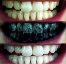 Cargar imagen en el visor de la galería, BlanquiDent™ 60 Gr